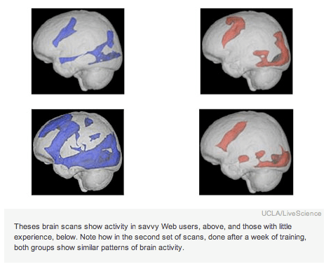 Brainphoto Brainphoto